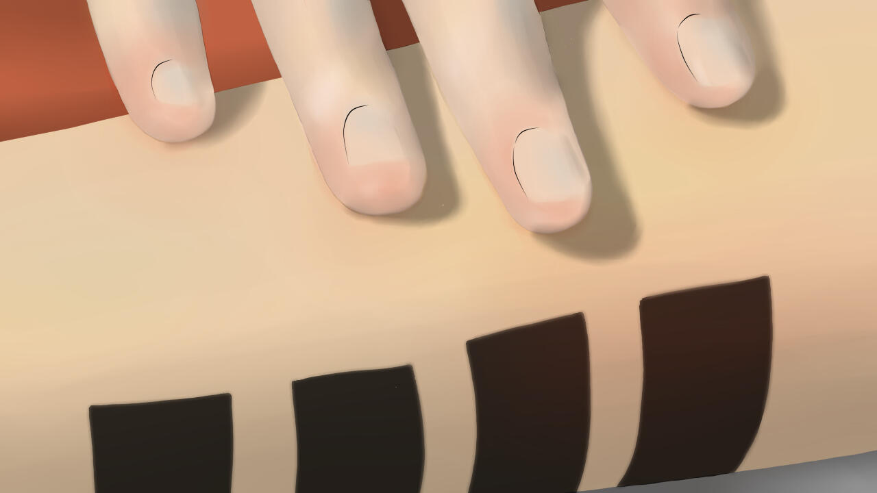 ...and White's arm